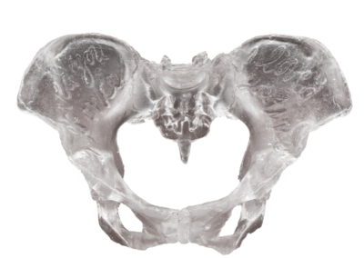 Melina Braß – I loved you once I loved you twice – 2025 – Epoxydguss – 30cm x 36cm x 25cm