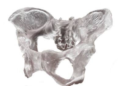 Melina Braß – I loved you once I loved you twice – 2025 – Epoxydguss – 30cm x 36cm x 25cm